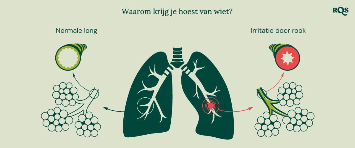 Diagram van de gezonde long vergeleken met de geïrriteerde long met ontsteking en gezwollen bronchieën door het roken van cannabis